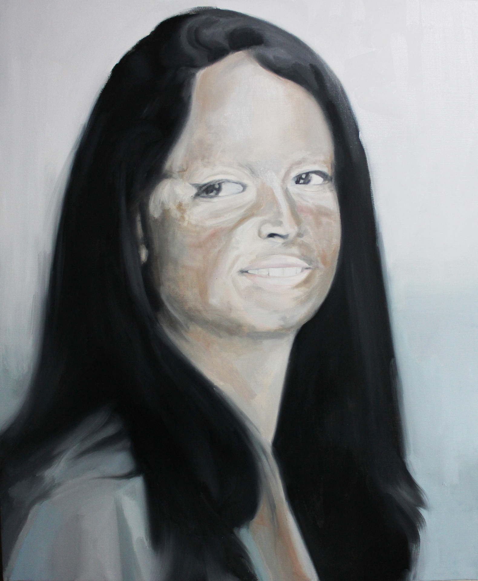 Acid Attack Victim (4)